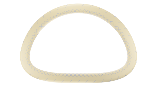 <p><span style="font-size:18pt;"><strong>NeoRing Mitral Annuloplasty Support Ring</strong> - Biologic Annuloplasty Support Ring</span></p>